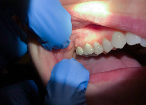 Best Emergency Care for Gum Disease in Brownfield, TX